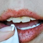 Gel Tẩy Da Chết Tự Nhiên Cho Môi Cay Xè Này Cực Kỳ Hiệu Quả